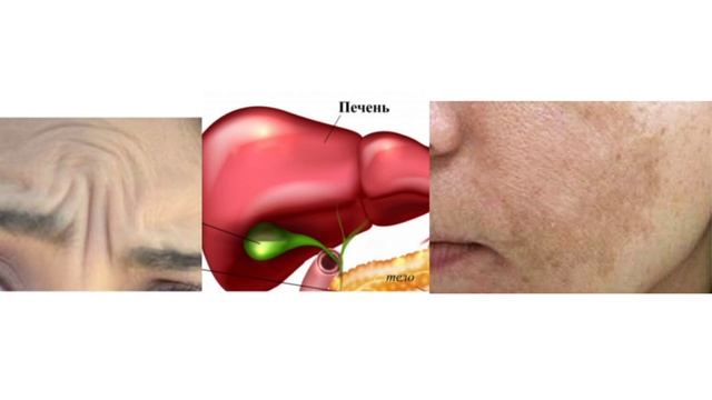 Как определить что болит печень или поджелудочная? смотреть онлайн