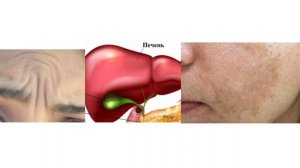 Как определить что болит печень или поджелудочная?