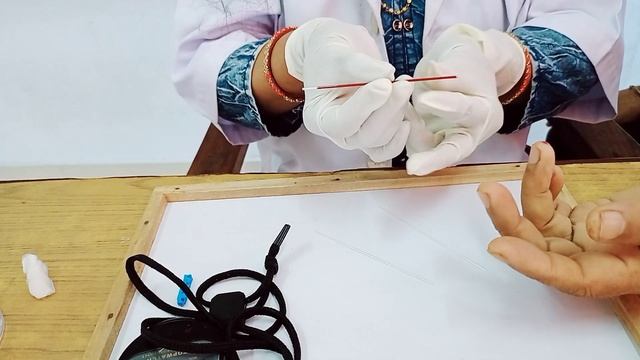 How To Do Clotting Time By Capillary Method// With Demo// смотреть онлайн