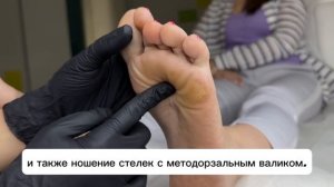 Натоптыши ? Причины образования