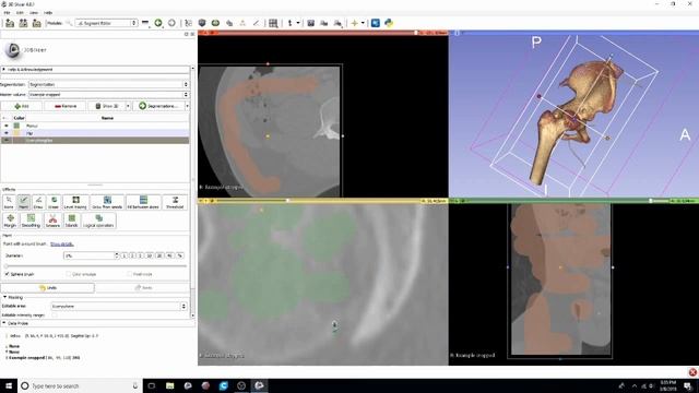 DICOM to STL Conversion Tutorial with Segment Editor смотреть онлайн
