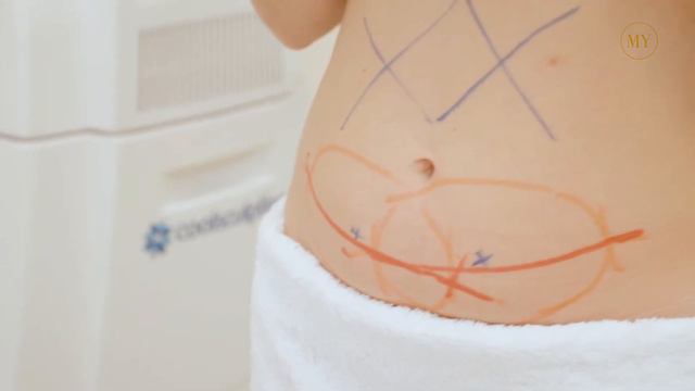 ¡REDUCE GRASA DE FORMA NO INVASIVA! смотреть онлайн