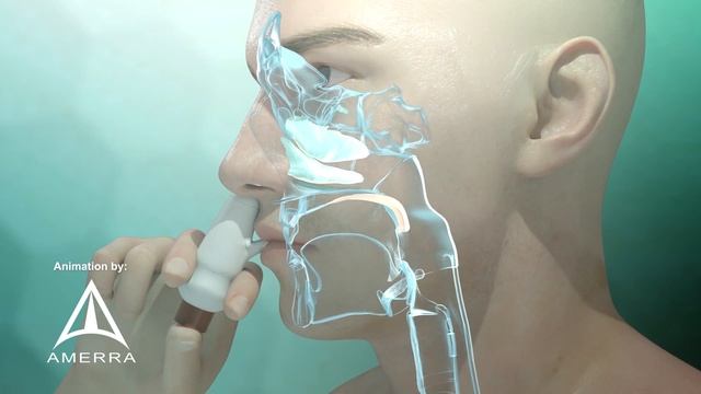 Fluticasone nasal spray (Flonase) - 3D medical animation смотреть онлайн