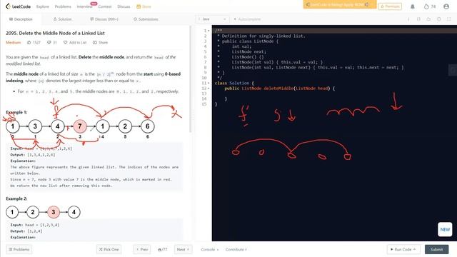 Delete the Middle Node of a Linked List | LeetCode 2095 | Two Approach | @LearnOverflow смотреть онлайн