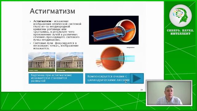 Астигматизм