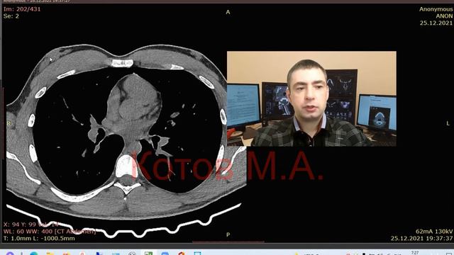 Гинекомастия. Ролик №16. смотреть онлайн