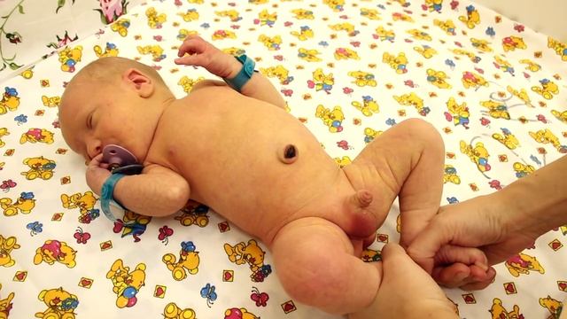 Нужен ли массаж новорожденному II ОВП смотреть онлайн