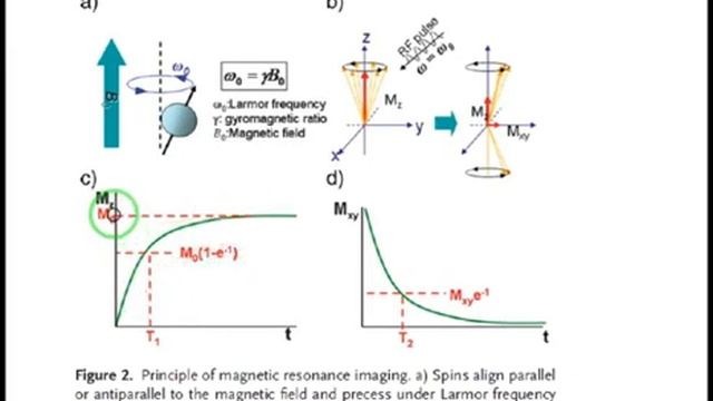 Imaging Techniques 18 - Magnetic Resonance Imaging (MRI) Part 1 смотреть онлайн
