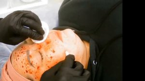 ПРАКТИКУМ: ХИДЖАМА НА ЛИЦО / КТ-ТЕРАПИЯ ЛИЦА