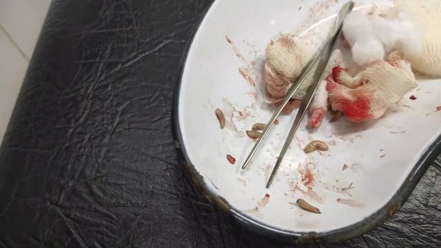 Укус мухи и личинки в веке глаза. Доктор вытаскивал пинцетом этих паразитов. смотреть онлайн