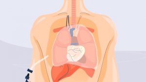 Люди, Которые Пережили Невероятное. Часть 3