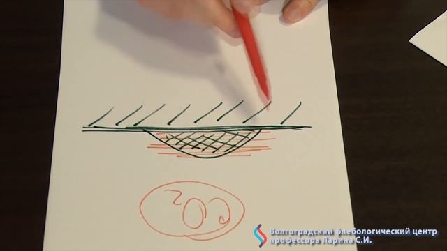 Папиллома. Что это? смотреть онлайн
