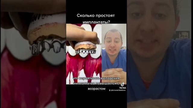 Сколько простоит имплант?#дантист #стоматолог #импланты #имплантаты #имплантациязубов #импланты #зуб смотреть онлайн