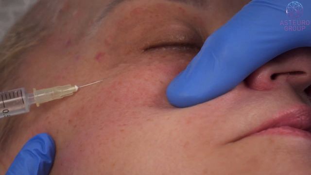 Mixyal Evolution. Биоревитализант мгновенного действия!