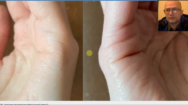 ОЗОР РУК НЕИЗВЕСТНОЙ ДЕВУШКИ. Хирообзор. смотреть онлайн