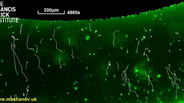 Amoeba Chemotaxis, SpeedX300