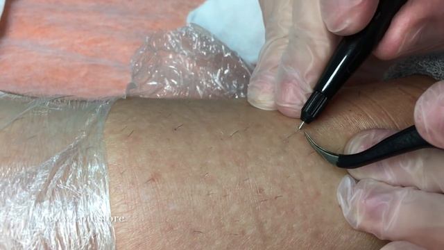 Первый переносной электроэпилятор - распаковка и обзор смотреть онлайн