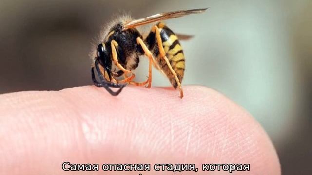 Укусила пчела — как снять опухоль смотреть онлайн