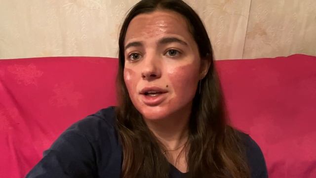 Химический пилинг ТСА 25% Подробный отчёт весь: процесс + до и после. Моя борьба с рубцами постакне смотреть онлайн