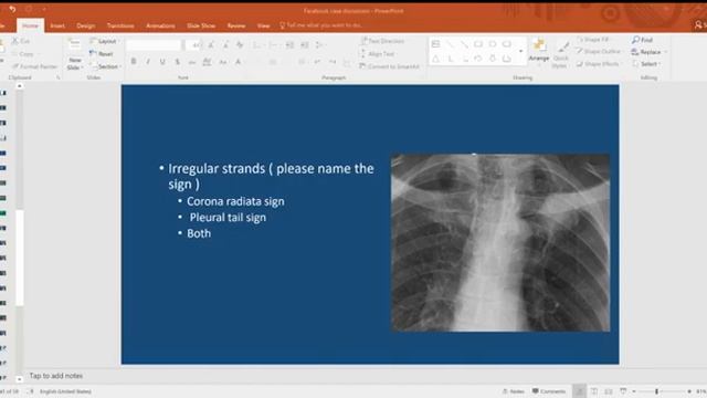 Facebook Case Discussion : adenocarcinoma of the lung смотреть онлайн
