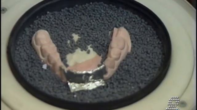 Окклюзионные шины. Часть 2 смотреть онлайн