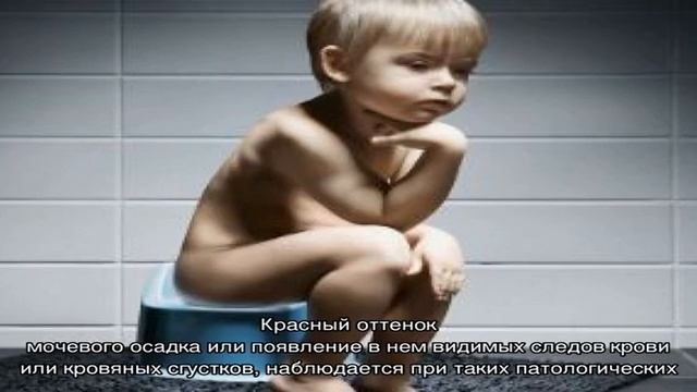 Почему бывает моча темного цвета у ребенка смотреть онлайн