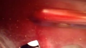 ЛОГАН. Корректор фар