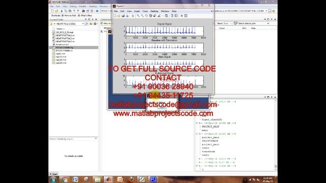 Matlab code for acoustic features for the identification of coronary artery disease смотреть онлайн