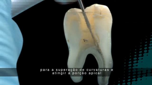 Ultradent's Endo-EZE AET Technique using TiLOS Files and EndoREZ Obturation, Portuguese Subtitles смотреть онлайн