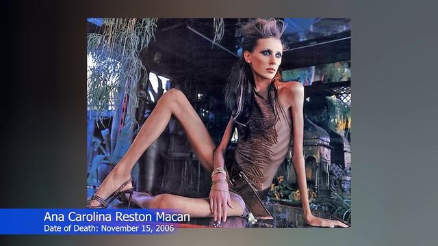 10 Celebrities Who Have Died Of Anorexia