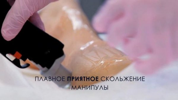 Александритовая эпиляция DEKA MOVEO