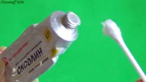 Папилломы ОТСОХНУТ! Копеечное АПТЕЧНОЕ средство для удаления папилломы.