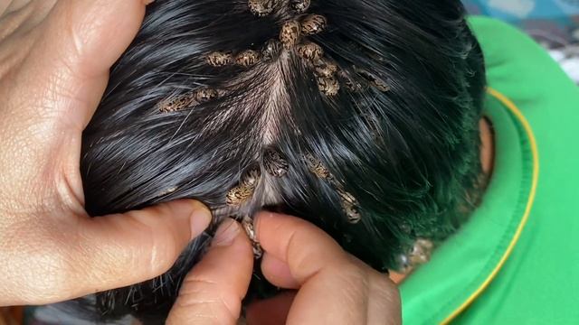 ticks visit my hair #001 смотреть онлайн
