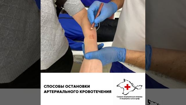 2. Способы остановки артериального кровотечения смотреть онлайн
