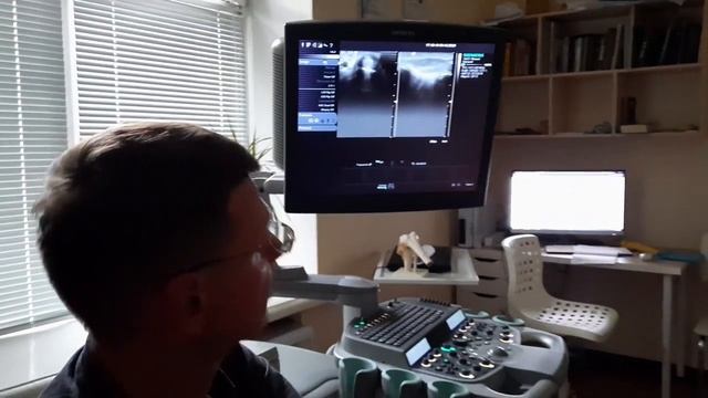 Болит, опухает первый палец при движениях. Как лечить воспаление сухожилий болезнь Де Кервена? смотреть онлайн