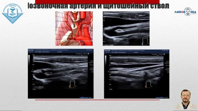 УЗИ брахиоцефальных сосудов. Часть 1