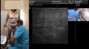 Стандарт УЗИ вен при варикозе (профессор Куликов В.П.)