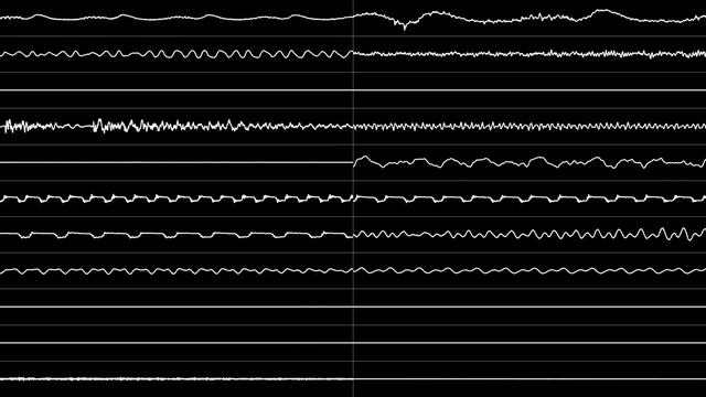 Robyn - “Sararr” (IT) [Oscilloscope View] смотреть онлайн