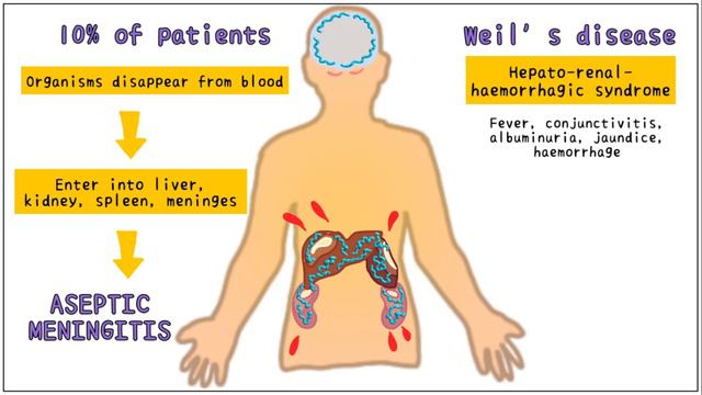 Leptospirosis: Microbiology, Diagnosis, Treatment, & Prevention