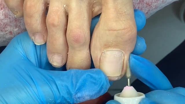 Гигиенический педикюр/#педикюр/