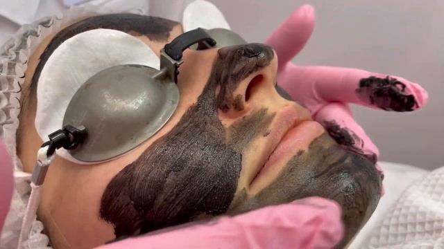 Карбоновый пилинг Q-Master Plus смотреть онлайн