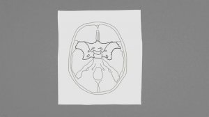 Тройничный нерв. Часть 1 - глазничный нерв.