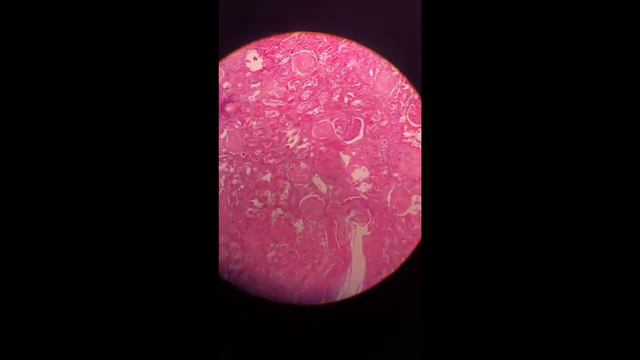 PATHOLOGY 2 || Microscope slides || Final exam || 9 смотреть онлайн