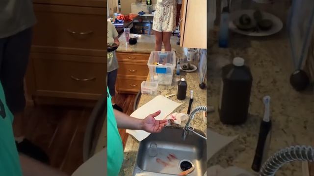 Fingers Cut - Wife Panics #shorts смотреть онлайн