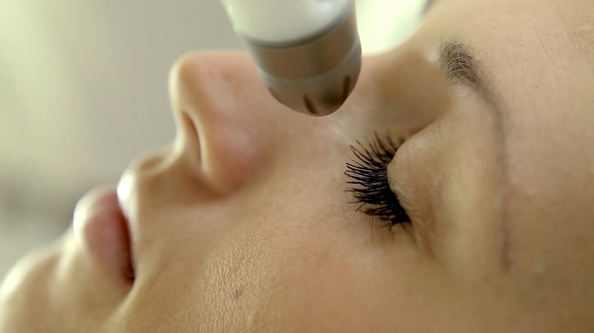 DERMADROP TDA - безинъекционная мезотерапия. смотреть онлайн