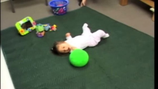 ABM Agenesis of the corpus callosum (ACC)