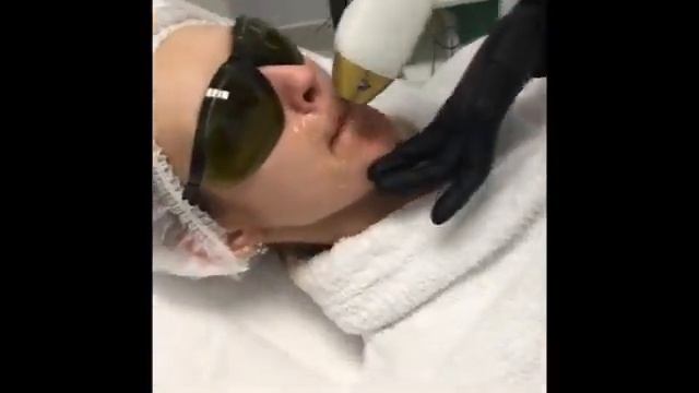 Эпиляция верхней губы смотреть онлайн
