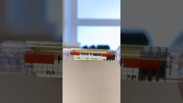 Мезотерапия в сочетании с лазерным лечением волосистой части головы на аппарате FOTONA.