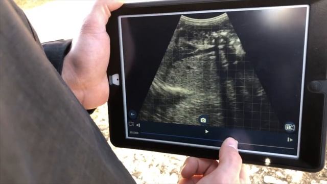 Easi Scan Go ultrasound смотреть онлайн