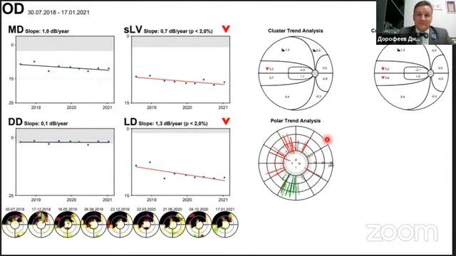 Нюанс пятый. Мониторинг глаукомы. смотреть онлайн